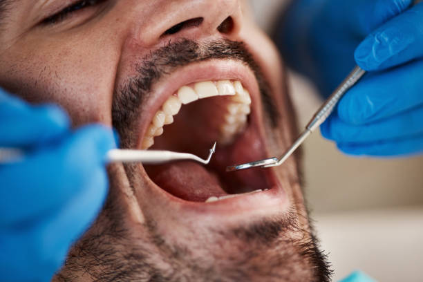 Best Urgent Tooth Repair  in Hearne, TX