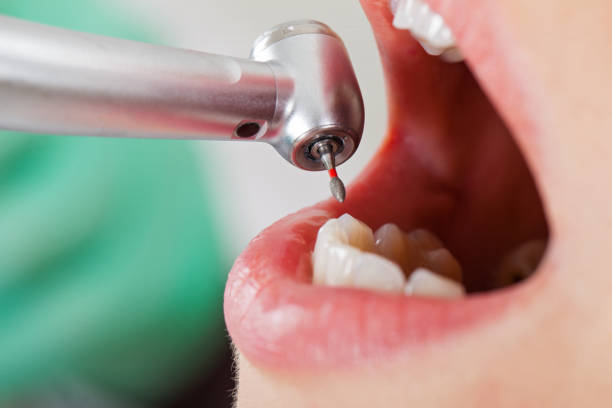 Best Cracked Tooth Emergency Dentist  in Hearne, TX